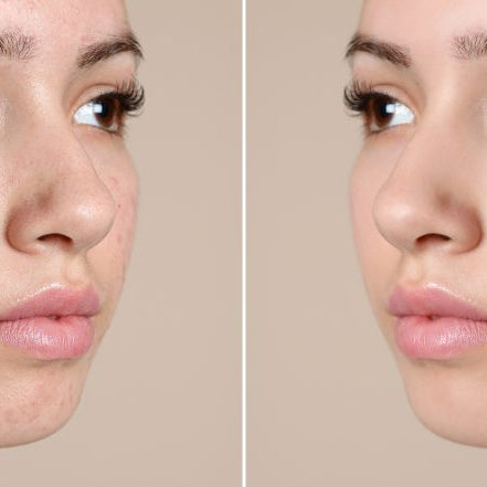 Why Plant-Based Exosomes Are the Next Big Thing in Skin Regeneration — And How Clinics Can Profit