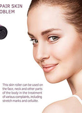 2.0mm Micro Needle Derma Skin Roller Needle Dermatology Therapy System
