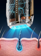 SMGT Sapphire IPL Hair Removal Device with Ice Cooling & 400,000 Flashes | 3-in-1 Hair Removal