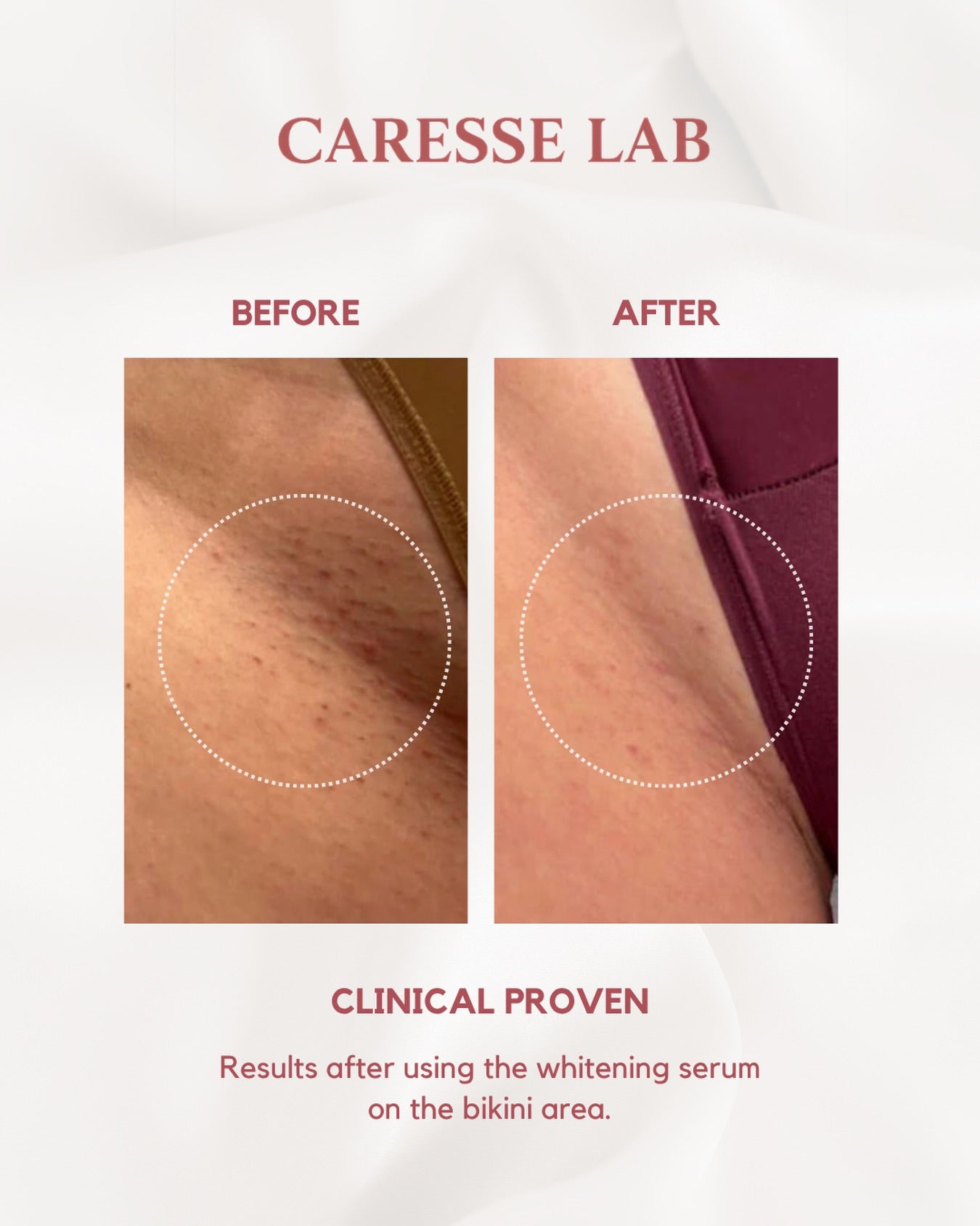 CARESSE Whitening Serum 30ml
