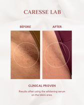 CARESSE Whitening Serum 30ml